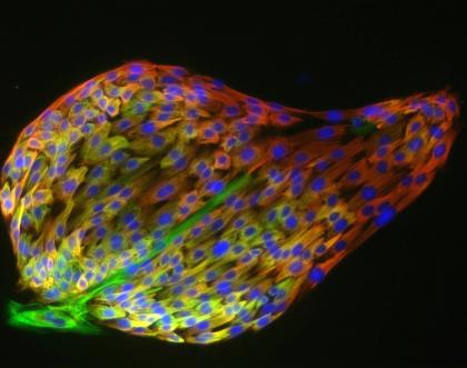 Cover image of Investigating signaling molecules in breast cancer 